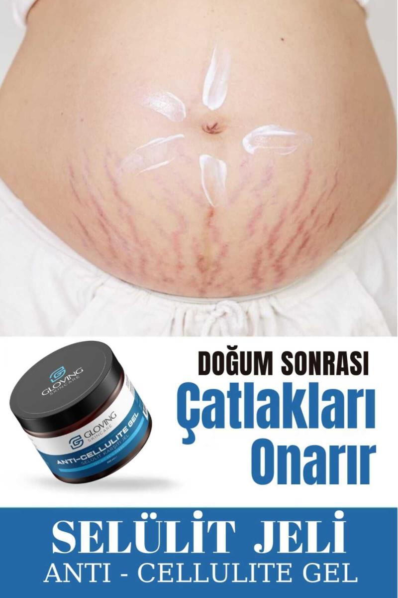 Doğum Sonrası Çatlak Kremi Kullananlar
