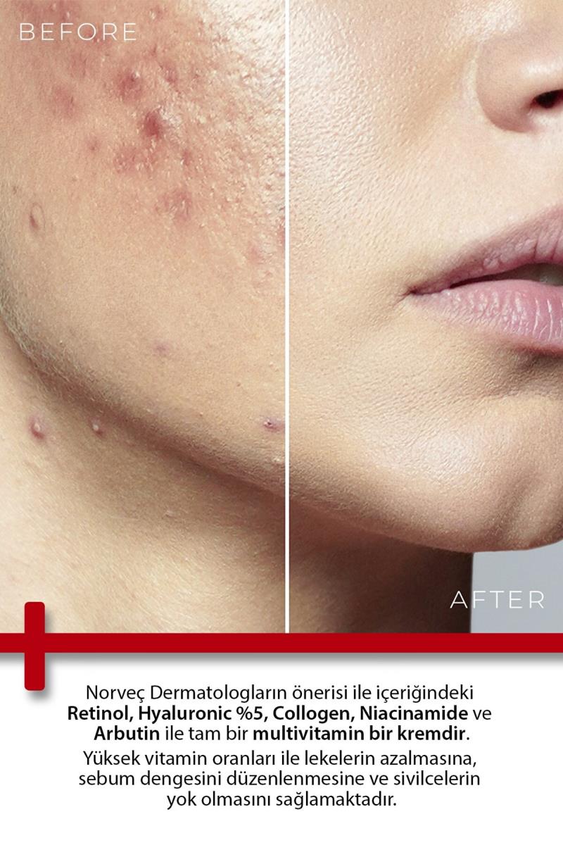 TODAYS CLİNİCALS Onarıcı Krem - Retinol Shea Butter Hyaluronic Acıd %5 Collagen % 2 Arbutin % 2 Nasıl kullanılır öğrenin ve  kullanıcı yorumlarına gözatın.